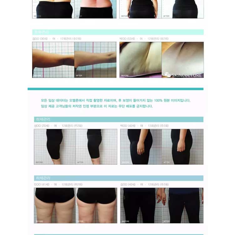 OMEGA Slim Light LED復合光療儀(圖9)